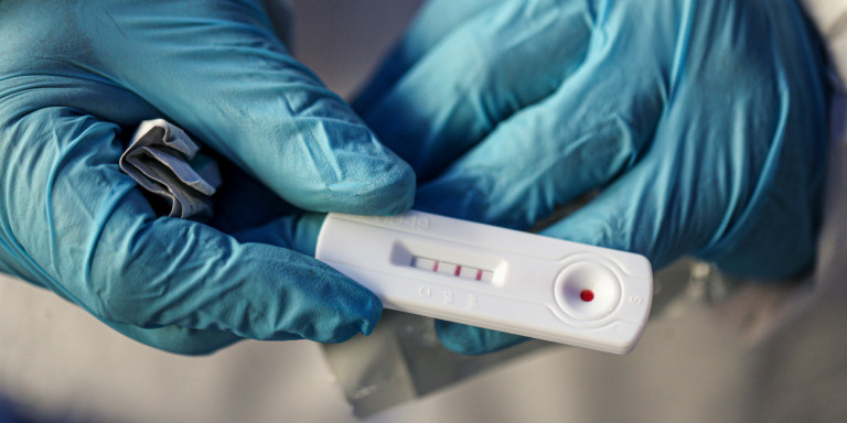 Κορωνοϊός: Σε 1.409 rapid tests που πραγματοποιήθηκαν χθες σε όλη τη χώρα τα 61 ήταν θετικά