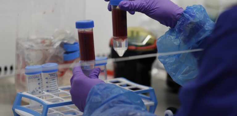 Κορωνοϊός – Έρευνα: Ποια ομάδα αίματος έχει μικρότερο κίνδυνο λοίμωξης