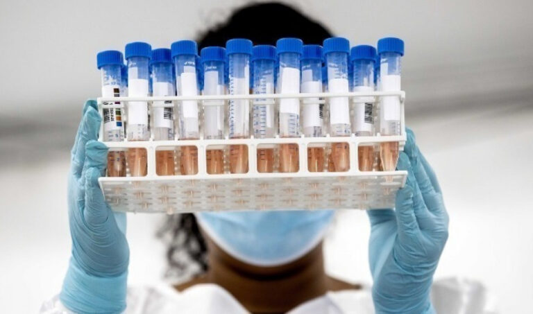 Κύπρος: Ρεκόρ κρουσμάτων κορωνοϊού με 93 νέα κρούσματα