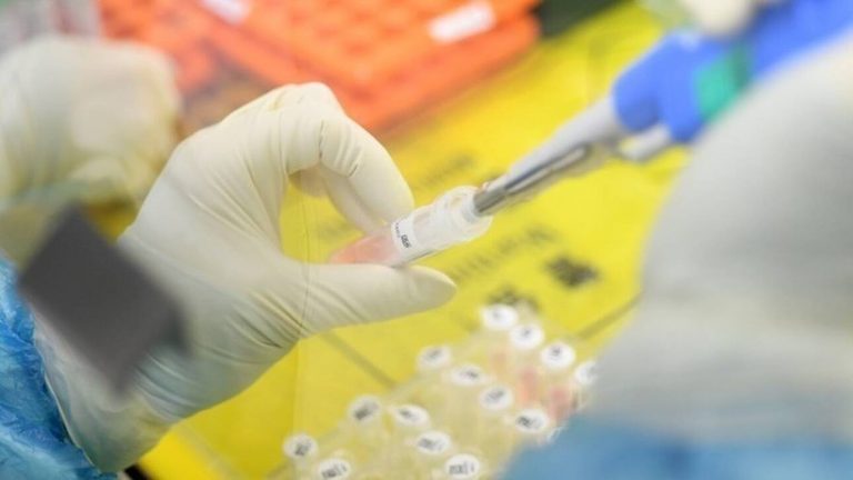 Κορωνοϊός: Η ΕΕ εξασφάλισε 55.000 δόσεις της θεραπείας μονοκλωνικών αντισωμάτων Roche-Regeneron