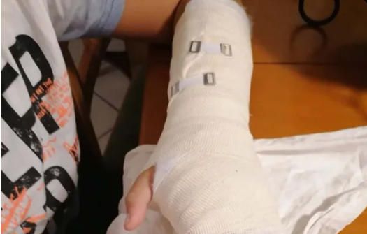 Κρήτη: Όργανο γυμναστικής έπεσε πάνω σε μαθητή – Τραυματίστηκε σοβαρά ο 12χρονος