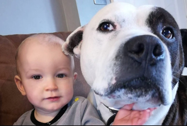 Σκύλος δάγκωσε άγρια 2χρονο παιδί στο πρόσωπο – Σοκαριστικές εικόνες
