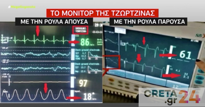 Ντοκουμέντο: Τι έδειχνε το μόνιτορ της Τζωρτζίνας όταν ήταν δίπλα της η Πισπιρίγκου και τι όταν δεν ήταν