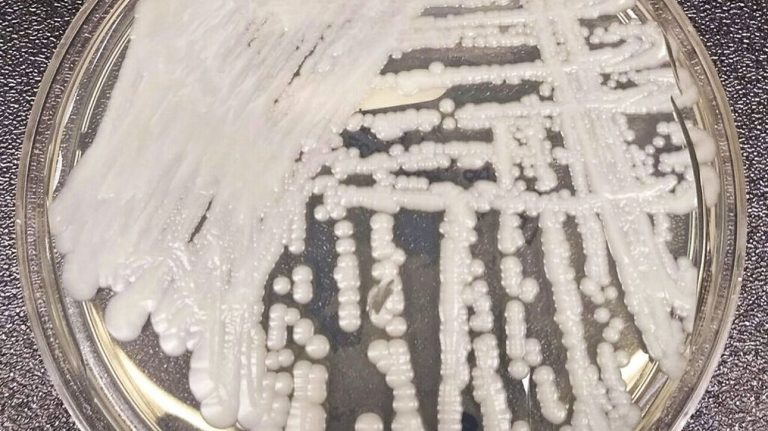 Candida Auris: Αυτή τη στιγμή δεν υπάρχει κάποια ενεργή συρροή