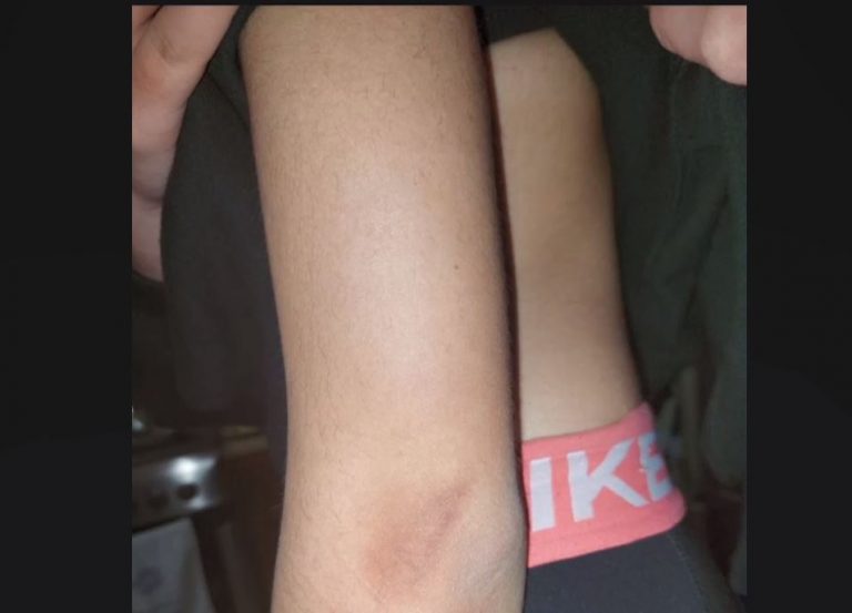 Μητέρα θύματος bullying: Επιτέθηκαν με σουγιά στην κόρη μου-Ο διευθυντής του σχολείου είπε ότι δεν μπορεί να κάνει κάτι