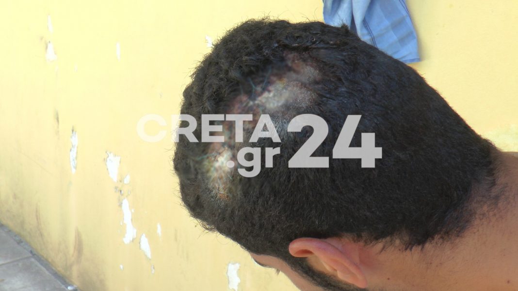 Κρήτη: Ένοχος ο εργολάβος για τον ξυλοδαρμό του 24χρονου εργάτη