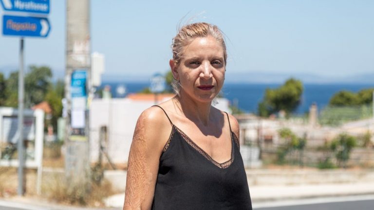 Mάτι, 4 χρόνια μετά: «Το έγκαυμα δεν σου καίει μόνο το σώμα, αλλά και την ψυχή»: Οι επιζήσαντες θυμούνται