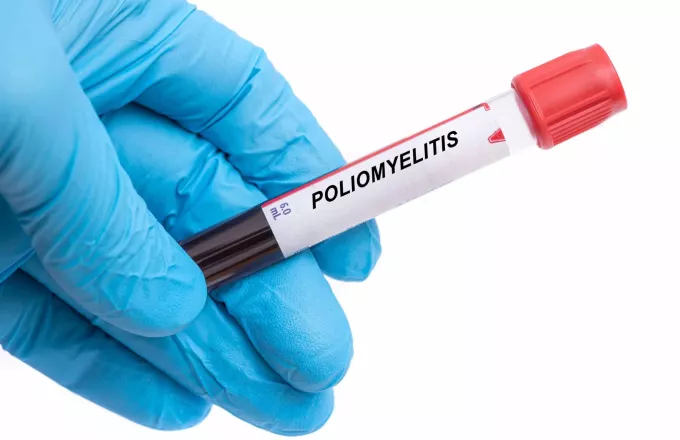 ΠΟΥ για πολιομυελίτιδα: Βαθιά ανησυχία για την πιθανότητα διεθνούς εξάπλωσης