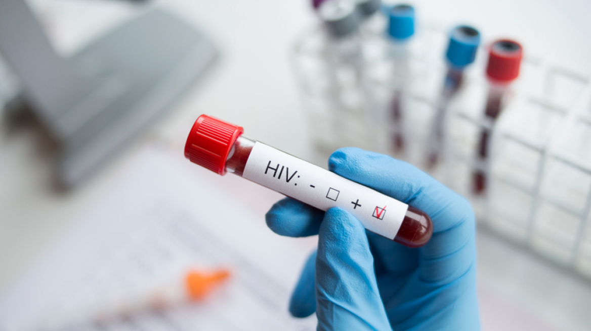 Φορέας του AIDS κατηγορείται ότι μετέδιδε τη νόσο σε συντρόφους του εν αγνοία τους