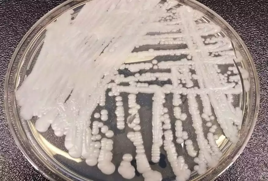 Candida Auris: Άλυτος γρίφος η προέλευση του φονικού μύκητα, που είναι υπερανθεκτικός στα αντιβιοτικά
