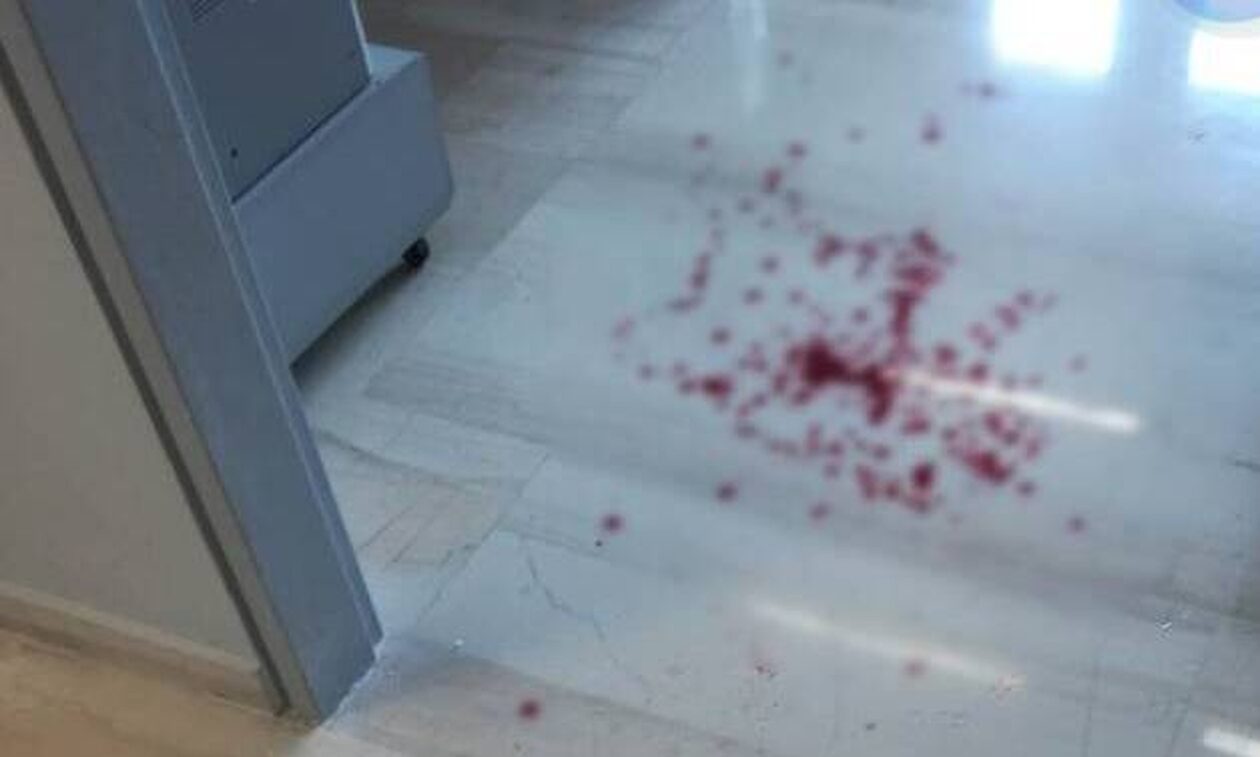 Άγριος καυγάς σε δημόσια υπηρεσία – Υπάλληλος χτύπησε πολίτη με κάδρο στο κεφάλι