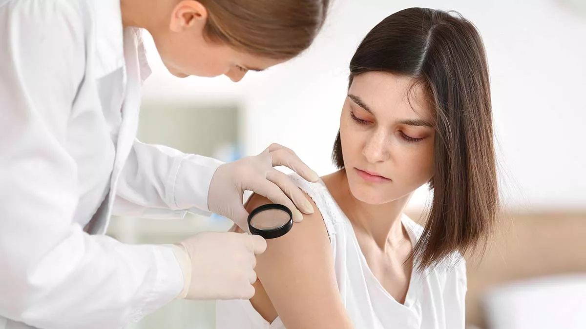 Δέρμα: Όλα όσα πρέπει να γνωρίζουμε για τις ελιές και την αφαίρεσή τους