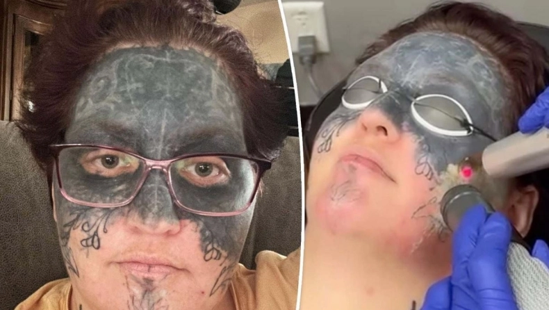 Τη νάρκωσαν και της έκαναν τατουάζ σε όλο της το πρόσωπο: Δέκα χρόνια μετά ο εφιάλτης της τελειώνει