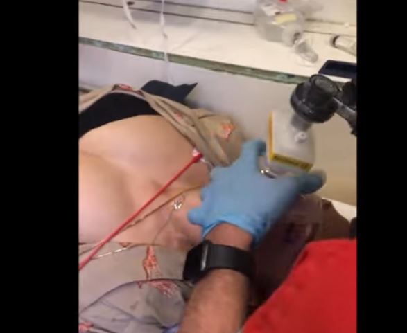 Τα κρίσιμα δευτερόλεπτα που έσωσαν 39χρονη μετά από δάγκωμα οχιάς – Συγκλονιστικό βίντεο
