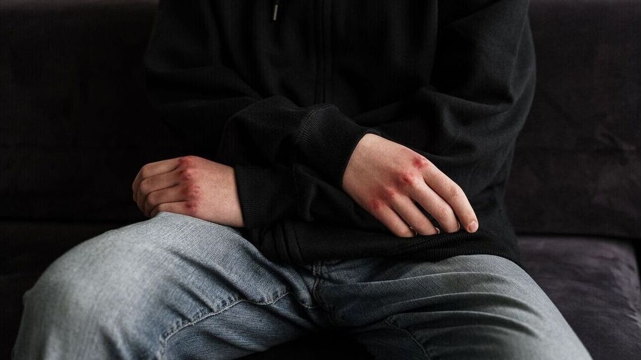 Στο νοσοκομείο με κρανιοεγκεφαλικές κακώσεις ο 18χρονος που δέχθηκε επίθεση στο σχολείο