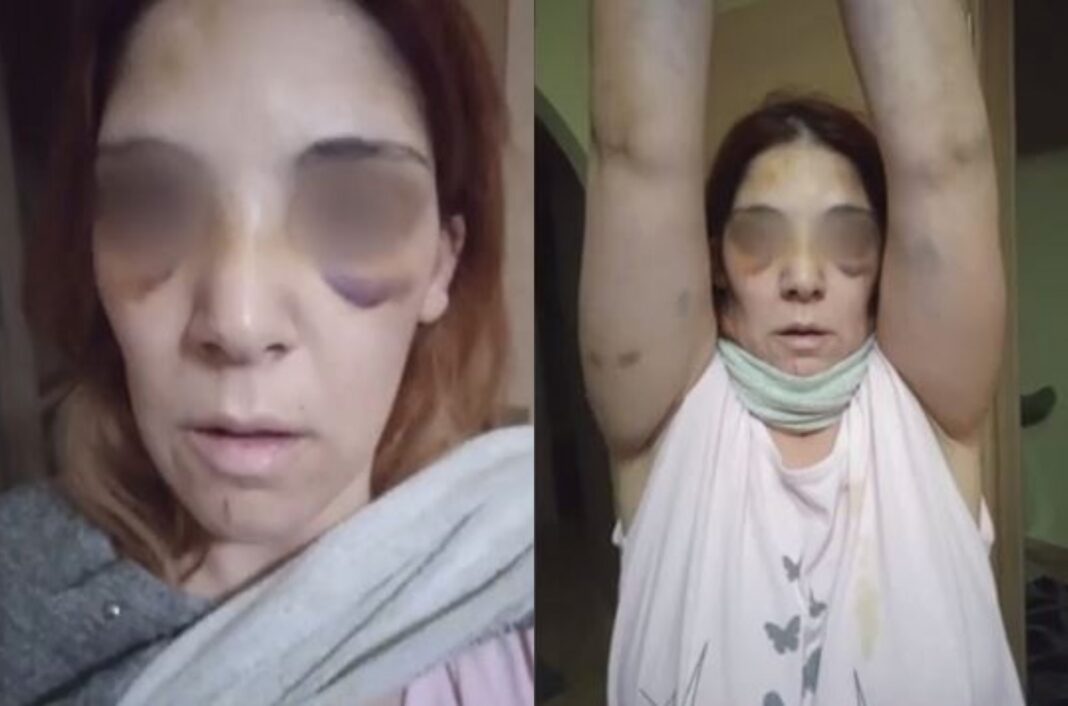 «Με έπνιγε με μαξιλαροθήκη, μου έβαζε μαχαίρι στο λαιμό» – Παγώνουν το αίμα οι περιγραφές της 32χρονης