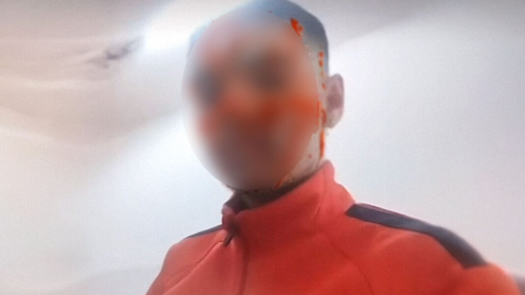 Όταν πίνει κάνει άσχημα πράγματα, λέει ο 15χρονος που κατήγγειλε τον πατέρα του για ενδοοικογενειακή βία