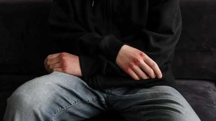 Περιστατικό άγριου ξυλοδαρμού μεταξύ ανηλίκων σε αυλή σχολείου
