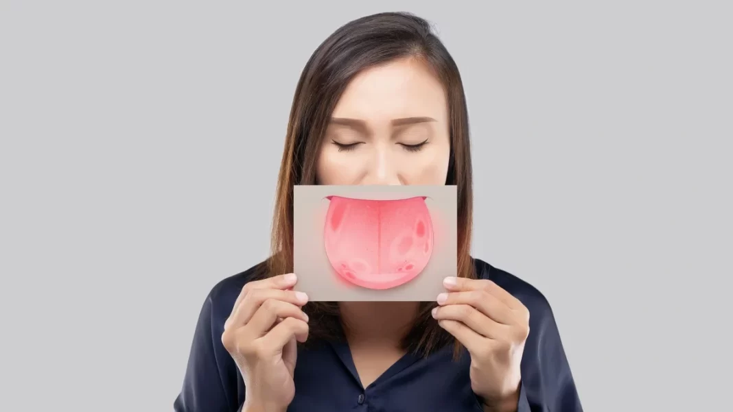 Τι σημαίνει αν έχετε ένα διαρκές αίσθημα καύσου στο στόμα