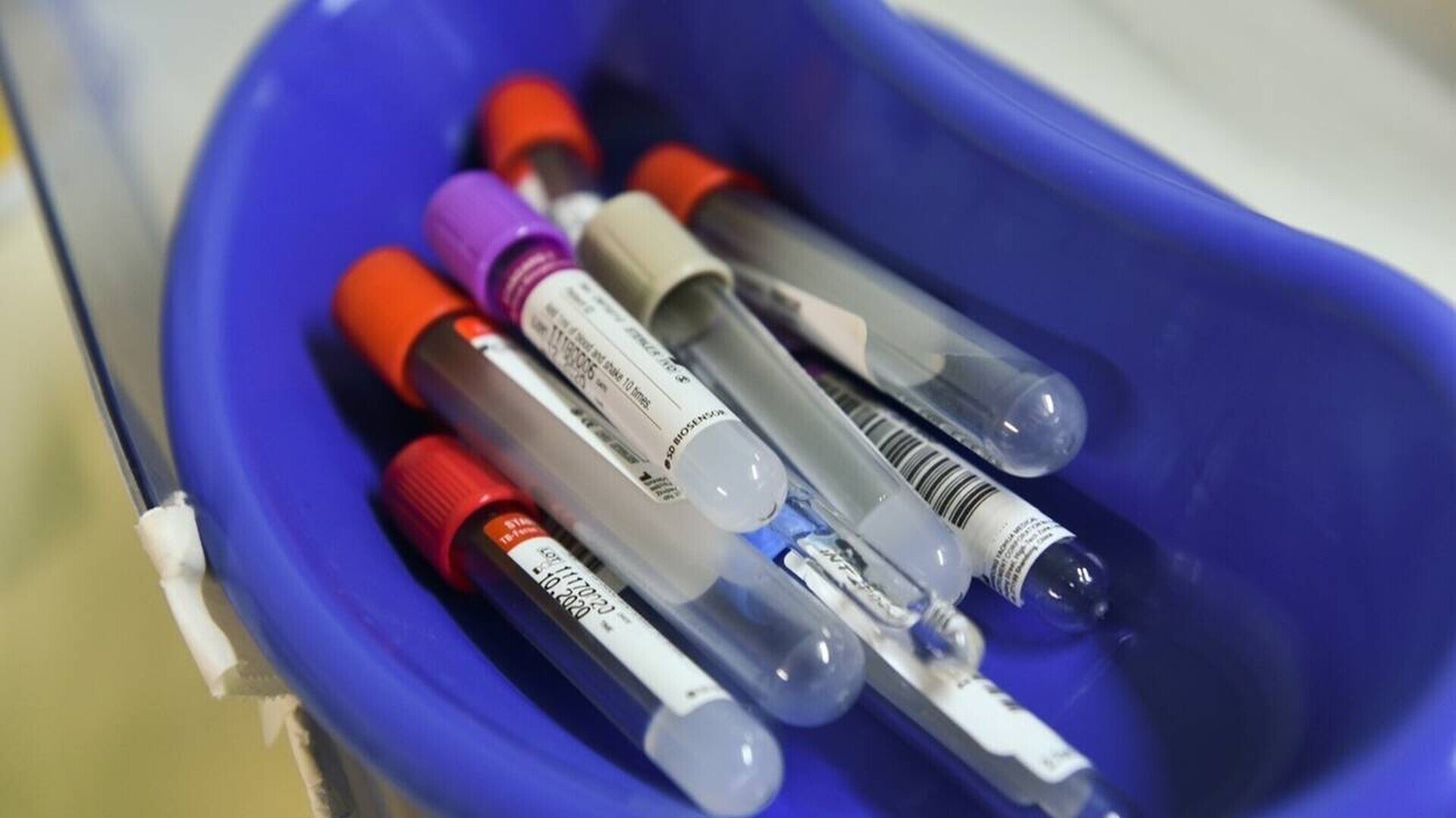 ΕΟΠΥΥ: Ποιοι εξαιρούνται από τις χρεώσεις έως 3 ευρώ για διαγνωστικές εξετάσεις