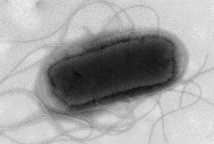 s712_E.coli_-1 Για αύξηση κρουσμάτων Ecoli προειδοποιεί η Υπηρεσία Ασφάλειας Υγείας του Ηνωμένου Βασιλείου