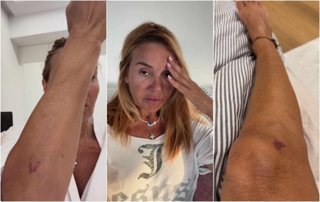 Βίντεο ντοκουμέντο: Η στιγμή που η Χριστίνα Παππά δέχεται επίθεση στη Γλυφάδα