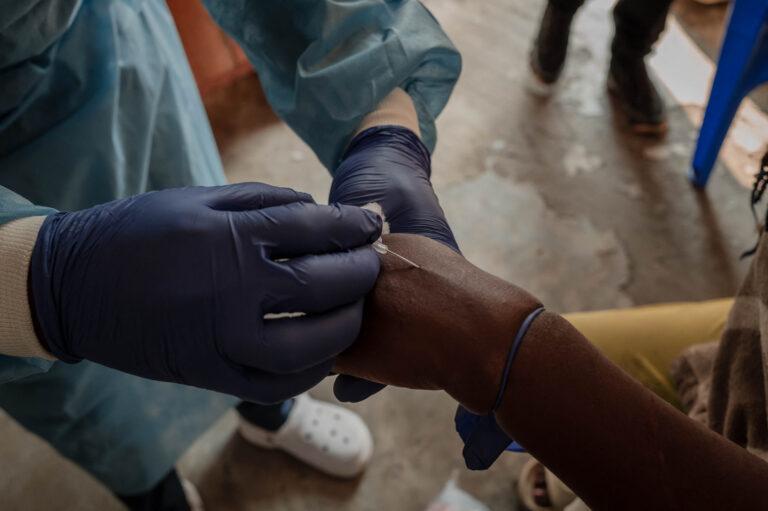Mpox: Πόσο πιθανό είναι να εξελιχθεί σε πανδημία