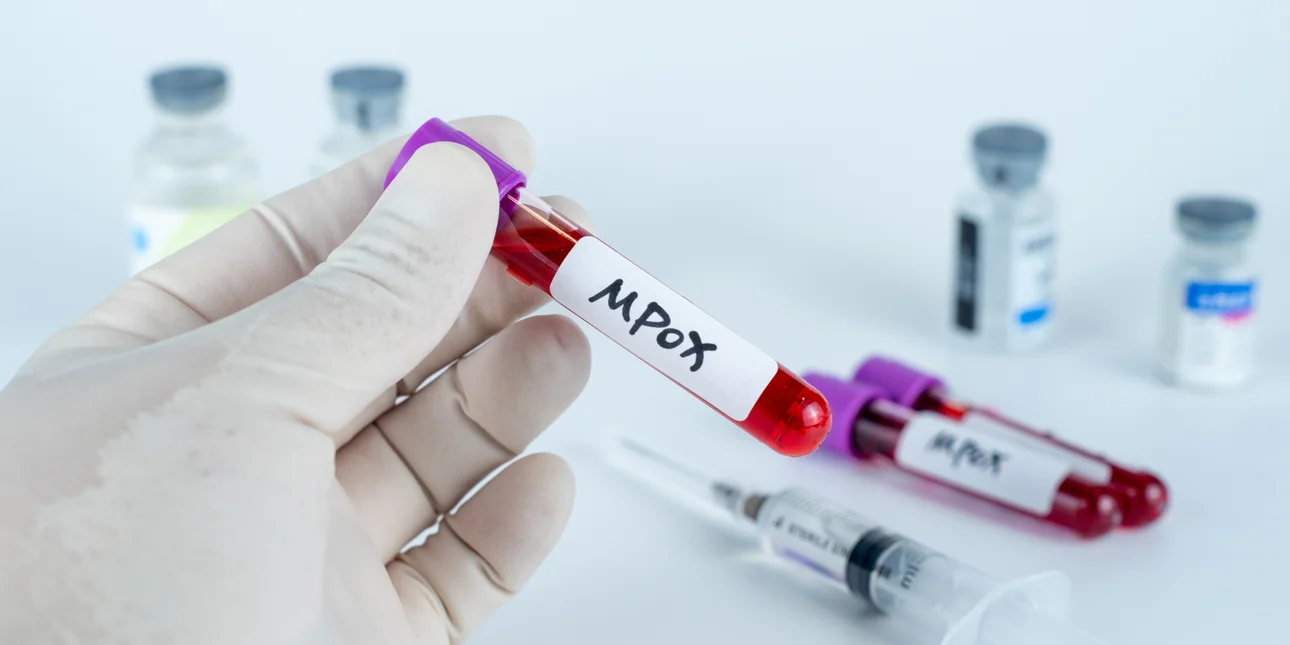 Παγκόσμια ανησυχία για τον ιό mpox: Αν αποτύχουμε στην αντιμετώπιση της εξάπλωσής του, οι συνέπειες μπορεί να είναι σοβαρές