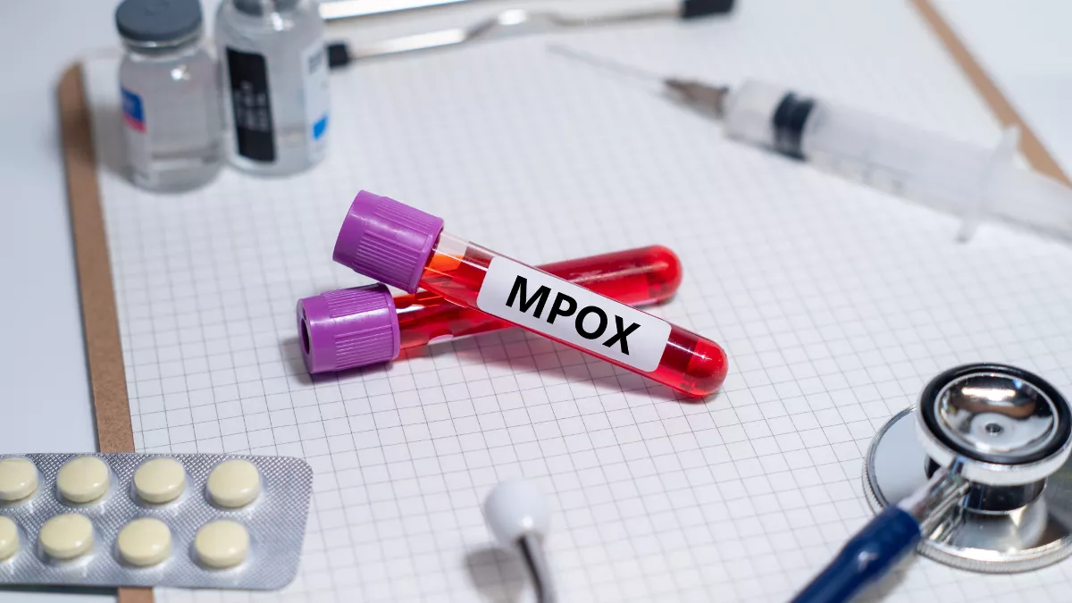 ECDC: Συνεχίζεται η διασπορά του ιού Mpox – «Πιθανώς να αυξηθούν τα κρούσματα από ταξίδια»