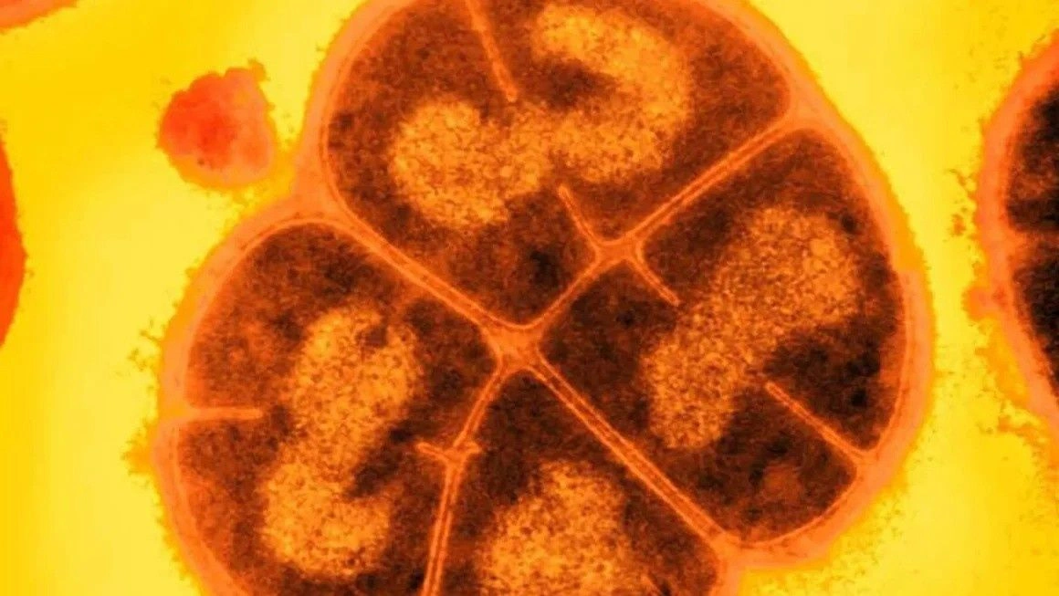 Πώς ο «Κόναν το Βακτήριο» μπορεί να μας σώσει από την επικίνδυνη ακτινοβολία