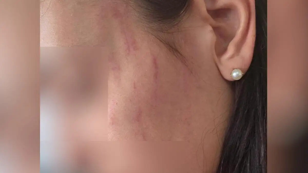 Σοκαριστικό βίντεο ντοκουμέντο από τον ξυλοδαρμό της 29χρονης Ηρακλειώτισσας από τον σύντροφό της