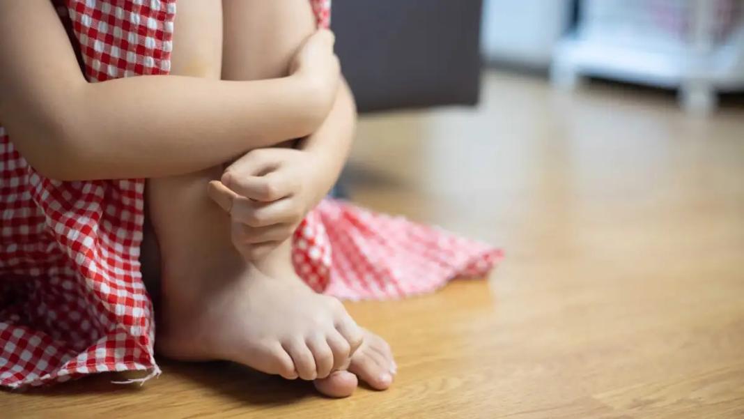 Βρετανία: Πέθανε ξαφνικά στα 26 «το κορίτσι που δεν έφαγε ποτέ»: Η συγκλονιστική ιστορία της που έγινε ντοκιμαντέρ