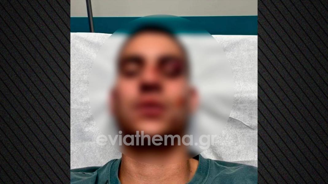 18χρονος έστειλε στο νοσοκομείο με κάταγμα 19χρονο επειδή έκανε like στη σύντροφό του