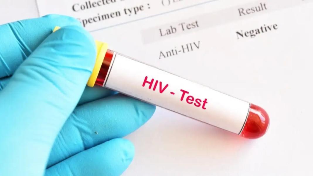 Νέα εποχή στη μάχη με τον ιό HIV: Οι ΗΠΑ ενέκριναν φάρμακο που θα μπορούσε να σταματήσει τη μετάδοση