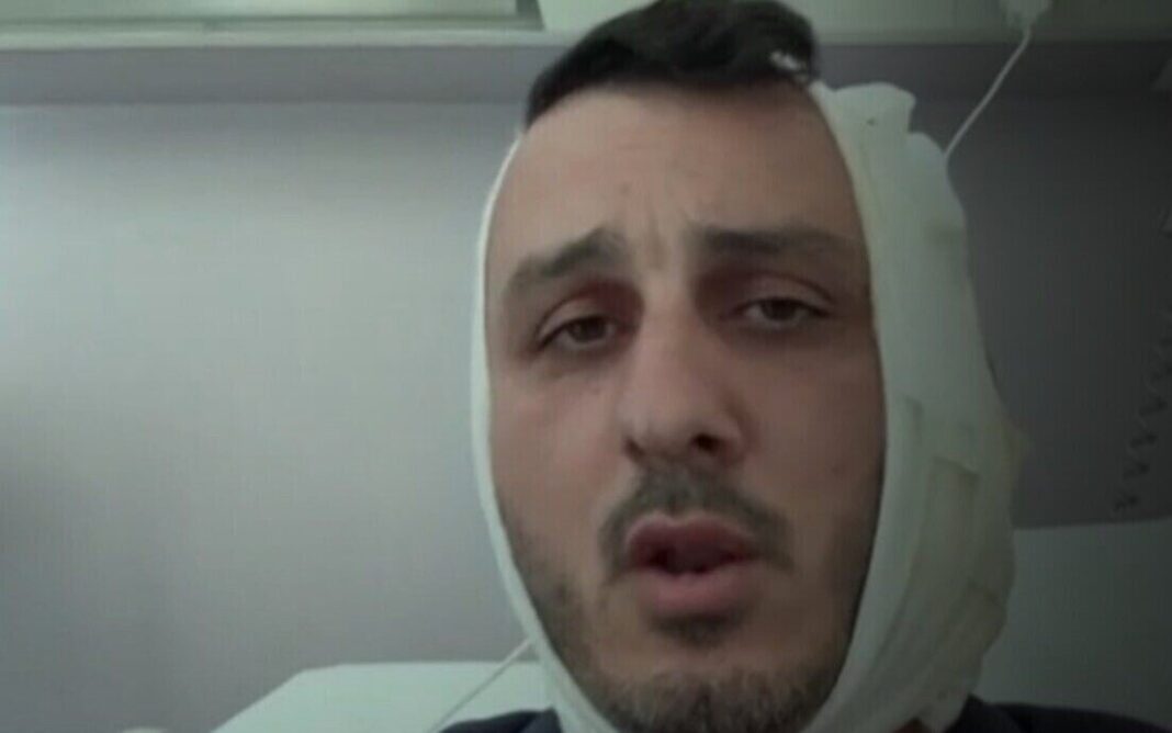 Ισραηλινός τουρίστας καταγγέλλει άγρια επίθεση σε παραλία – Του δάγκωσε το αυτί και φώναζε «είμαι Χαμάς»
