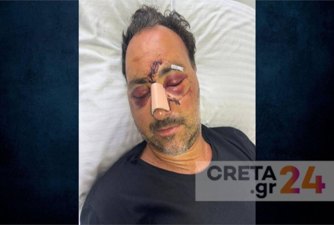 Ελεύθεροι οι δύο κατηγορούμενοι για τον ξυλοδαρμό του Ελληνοκαναδού χρηματιστή στο Ηράκλειο