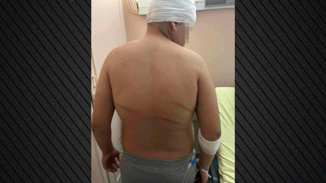 Κατ’ οίκον περιορισμός στον 18χρονο για την άγρια επίθεση σε 13χρονο  – Διαφώνησαν εισαγγελέας και ανακριτής