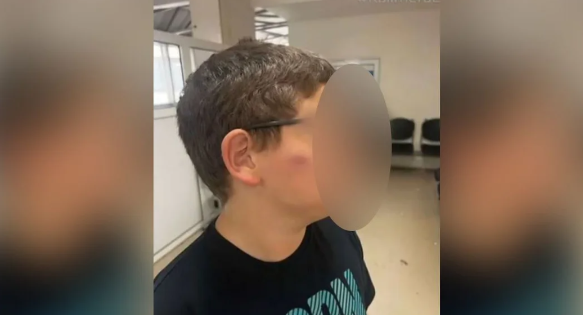 Θεσσαλονίκη: 11χρονος ξυλοκοπήθηκε από συμμαθητές την ώρα διαλείμματος