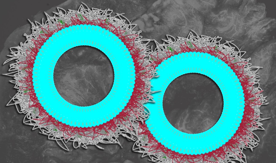 MIT-Ovarian-Cancer-01-press_0 ΜΙΤ: Ερευνητές ανέπτυξαν νανοσωματίδια κατά του καρκίνου των ωοθηκών