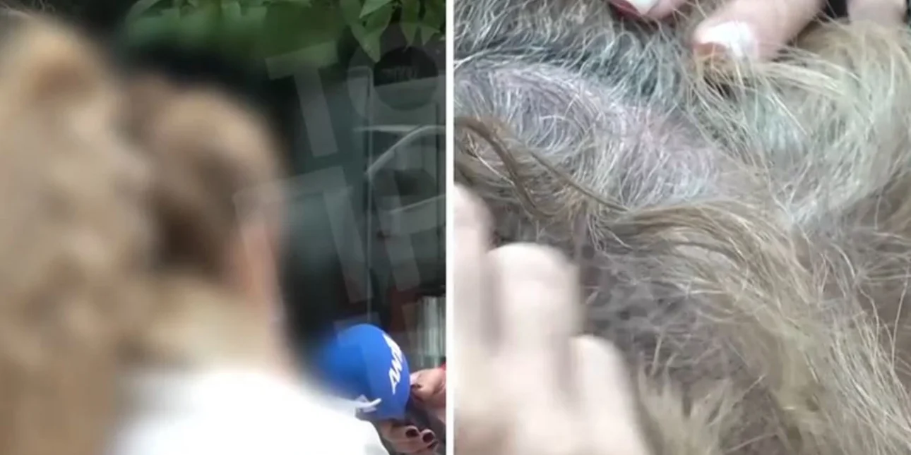 Σε σοκ η 43χρονη θύμα ξυλοδαρμού από πλαστικό χειρουργό: Αν δεν σταμάταγαν οι περαστικοί, θα με σκότωνε