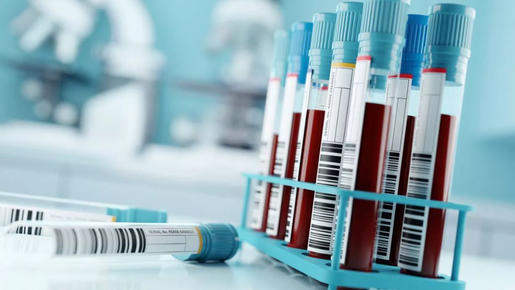 Πότε απεργούν οι εργαστηριακοί γιατροί – Τα αιτήματά τους