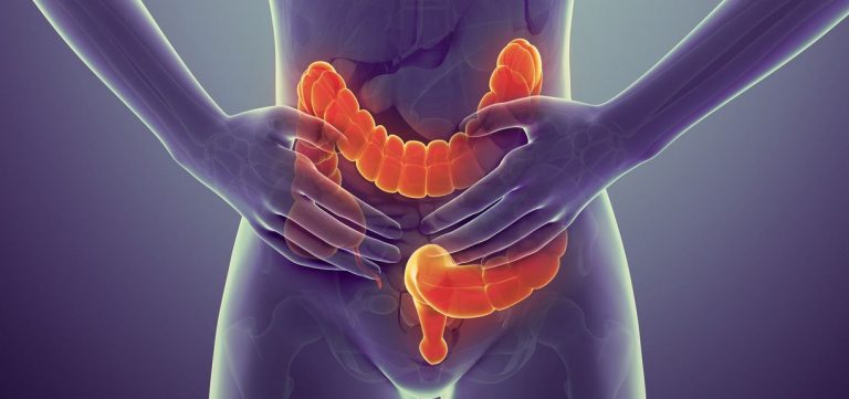 Διατροφή για ευερέθιστο έντερο: Ποια είναι η πιο κατάλληλη