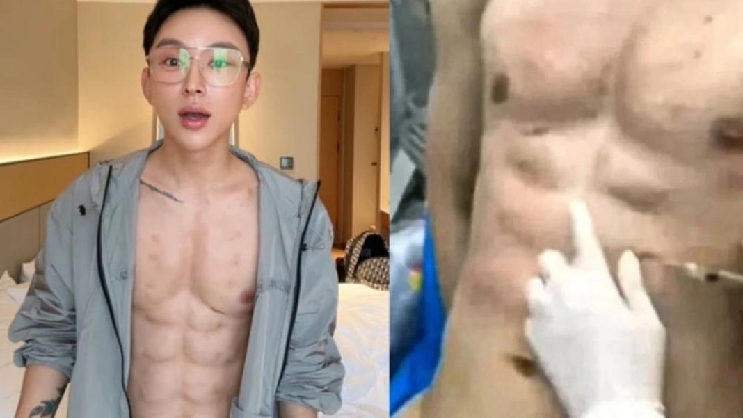 Influencer ξόδεψε πάνω από 500.000 δολάρια για… ψεύτικους κοιλιακούς