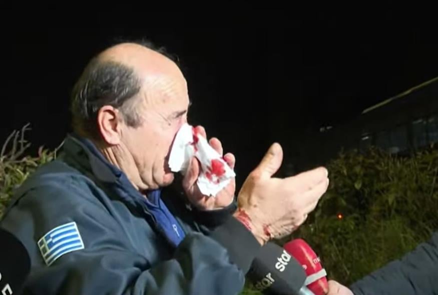 Λάρισα: Ασθενοφόρο έπεσε πάνω σε κλούβα της αστυνομίας που είχε κλείσει τον δρόμο – Τραυματίστηκε ο συνοδηγός