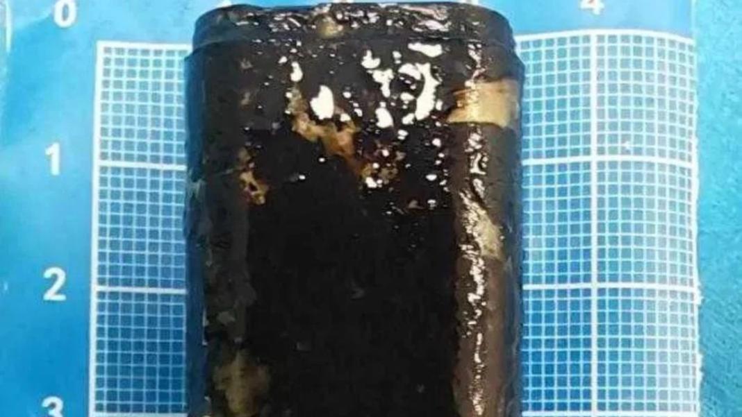 Κίνα: Κατάπιε αναπτήρα για challenge και 30 χρόνια μετά λειτουργούσε