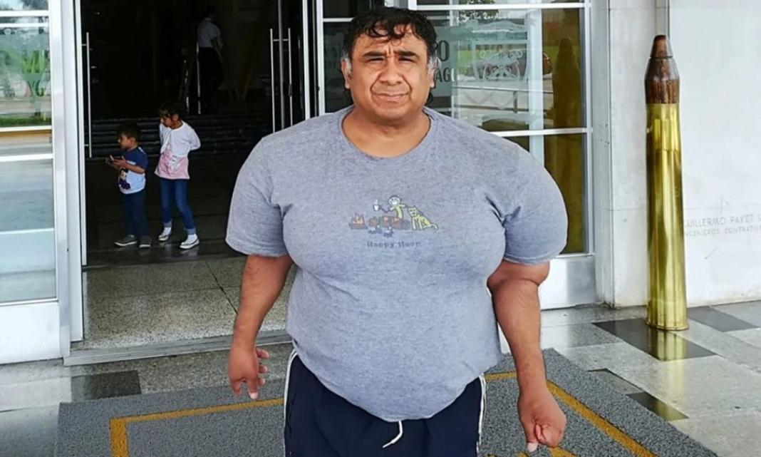 Δύτης έχει «φυσαλίδες αζώτου» στο σώμα εδώ και 11 χρόνια – «Ζω σαν φουσκωμένο μπαλόνι»