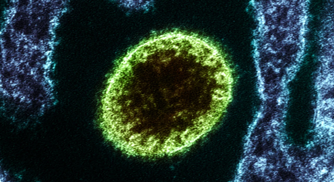 Ιός Nipah: Δύο νέα περιστατικά στην Ινδία – Πώς μεταδίδεται, πόσο κινδυνεύει η Ευρώπη