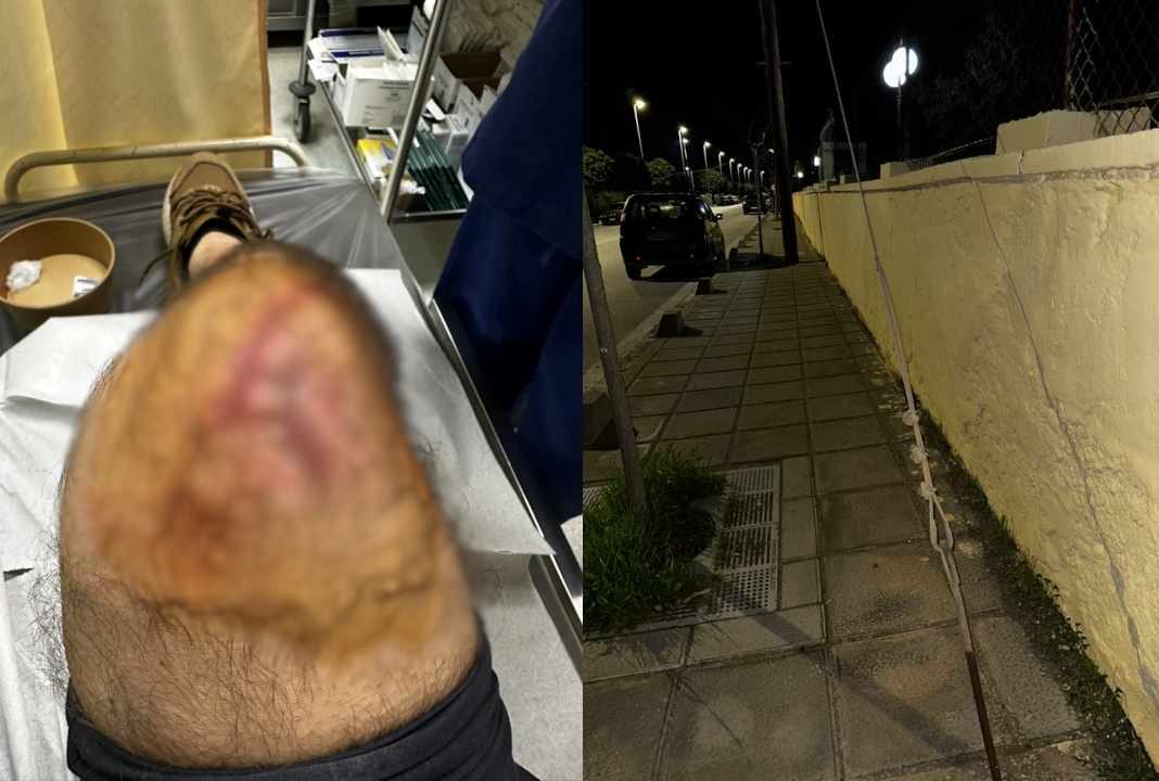 Ηράκλειο: Από το πεζοδρόμιο-παγίδα στο νοσοκομείο πολίτης – Καμία παρέμβαση μετά τον σοβαρό τραυματισμό του